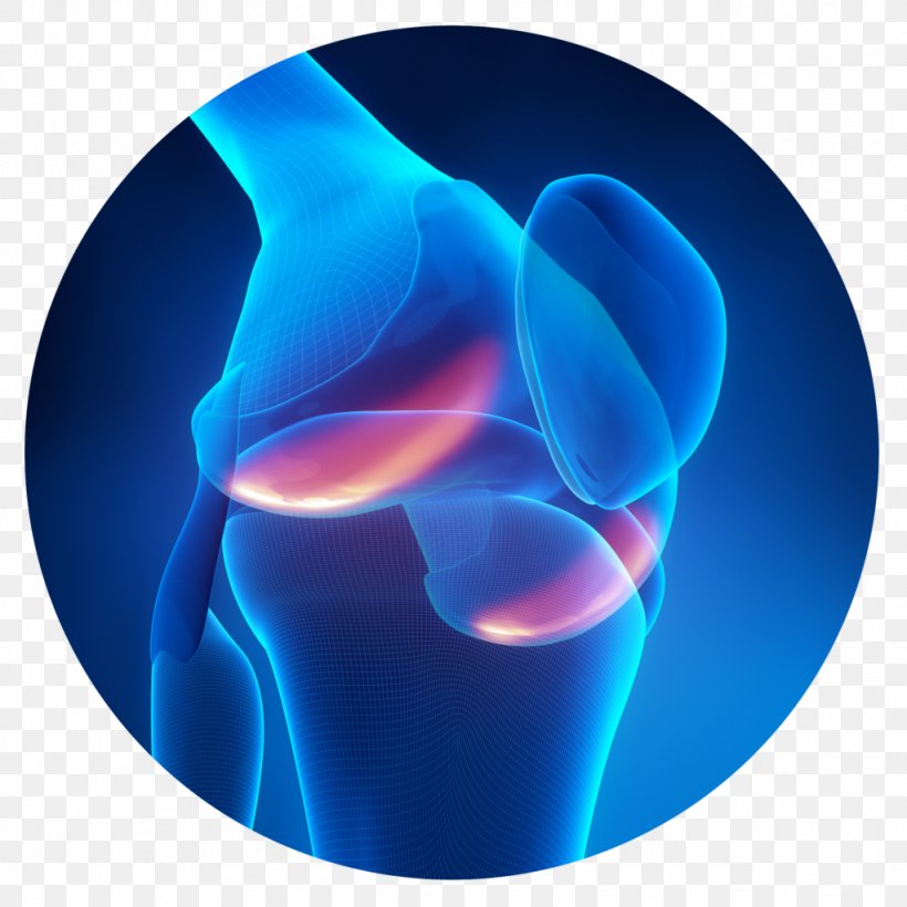 Knee Pain Bone Pain Joint, PNG, 1024x1024px, Knee Pain, Ache, Arthritis, Bone, Bone Pain Download Free