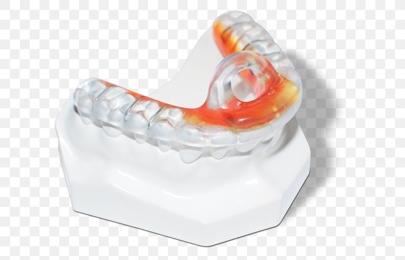 Mandible Bite Registration Tooth Temporomandibular Joint, PNG, 625x528px, Mandible, Bite Registration, Dentist, Home Appliance, Jaw Download Free