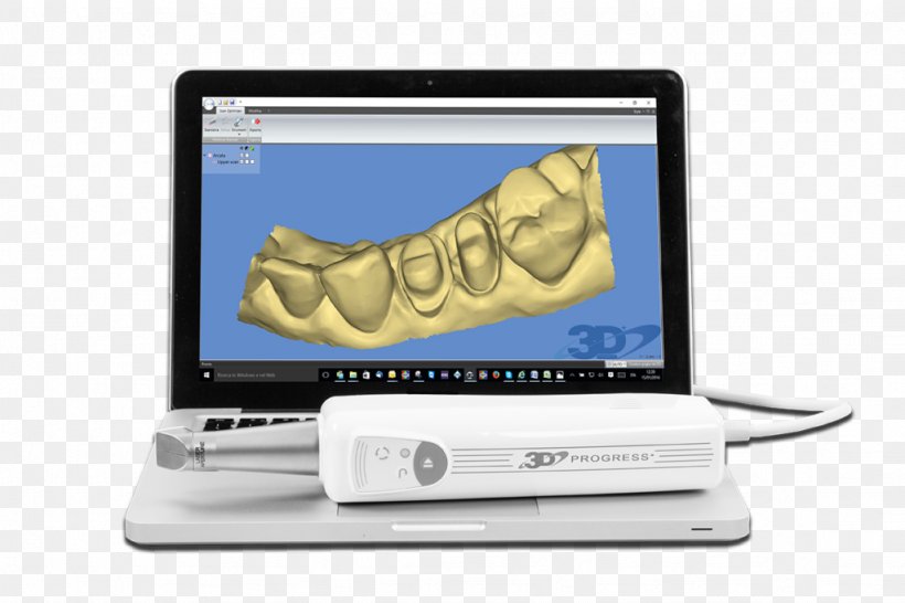 3D Scanner Image Scanner 3D Computer Graphics Three-dimensional Space Scansione, PNG, 1024x682px, 3d Computer Graphics, 3d Printing, 3d Scanner, Brand, Computer Software Download Free