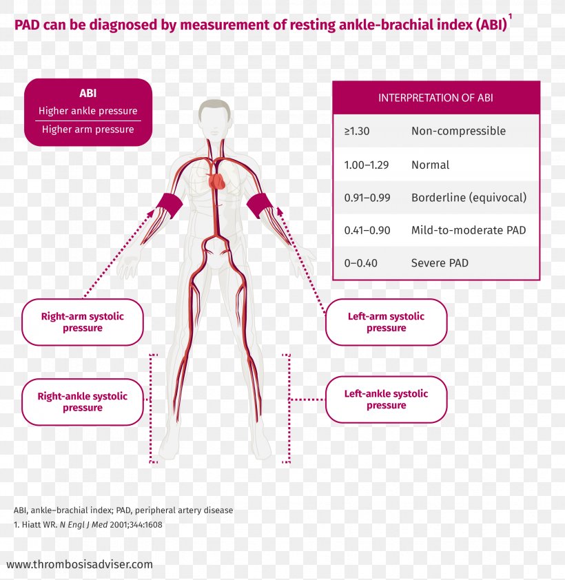 Peripheral Artery Disease Ankle–brachial Pressure Index Peripheral Vascular System Medical Diagnosis, PNG, 3293x3383px, Watercolor, Cartoon, Flower, Frame, Heart Download Free