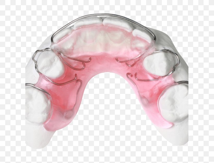 Gergen's Orthodontic Lab Gergens Orthodontic Lab Orthodontic Technology Orthodontics Bionator, PNG, 625x625px, Gergens Orthodontic Lab, Bionator, Home Appliance, Jaw, Neck Download Free