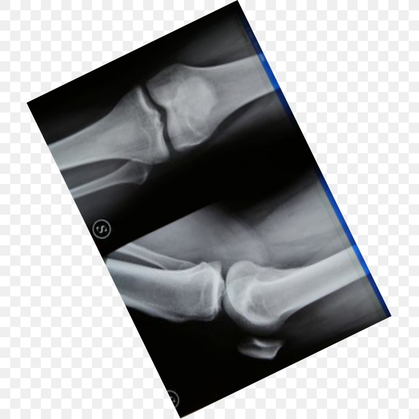Miami Beach Osteopathy Tuxedo Sweater Knee, PNG, 715x820px, 2018, Miami Beach, Bar, Biomechanics, Black And White Download Free