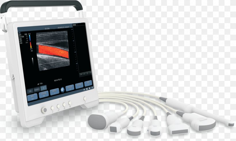 Ultrasonography Doppler Echocardiography Ultrasound Medical Imaging Medical Equipment, PNG, 1132x675px, Ultrasonography, Angiography, Communication, Dog, Doppler Echocardiography Download Free