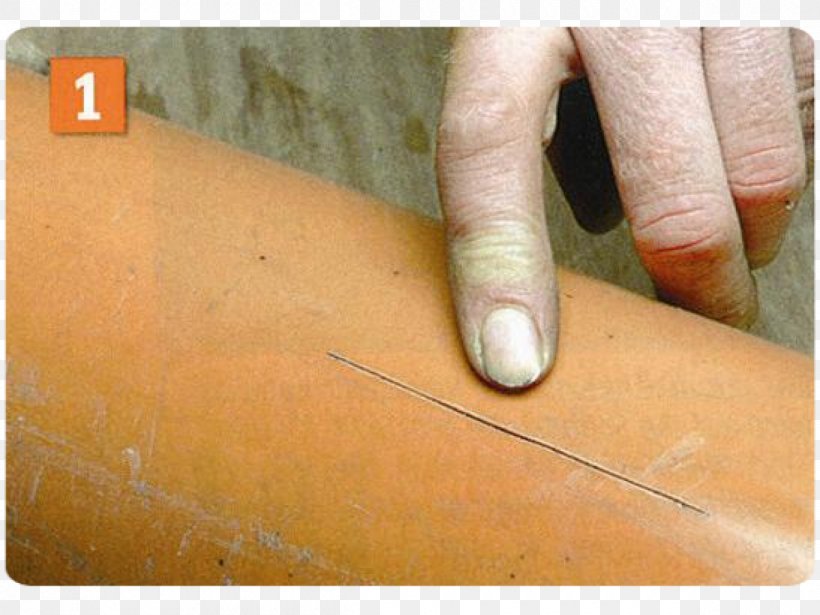 Thumb Close-up Nail Angle, PNG, 1200x900px, Thumb, Acupuncture, Closeup, Finger, Hand Download Free
