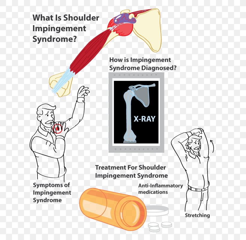 Impingement Syndrome Supraspinatus Muscle Pain Inflammation, PNG, 650x800px, Watercolor, Cartoon, Flower, Frame, Heart Download Free