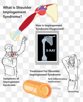 Torn In Places - Impingement Syndrome Supraspinatus Muscle Pain Inflammation PNG