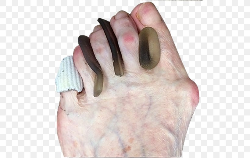 Nail Thumb Toe, PNG, 510x520px, Nail, Finger, Foot, Hand, Jaw Download Free