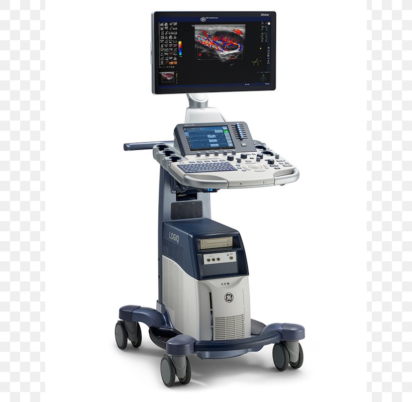 Home Ultrasound Ultrasonography GE Healthcare Voluson 730, PNG, 800x800px, Ultrasound, Ge Healthcare, General Electric, Health Care, Home Ultrasound Download Free