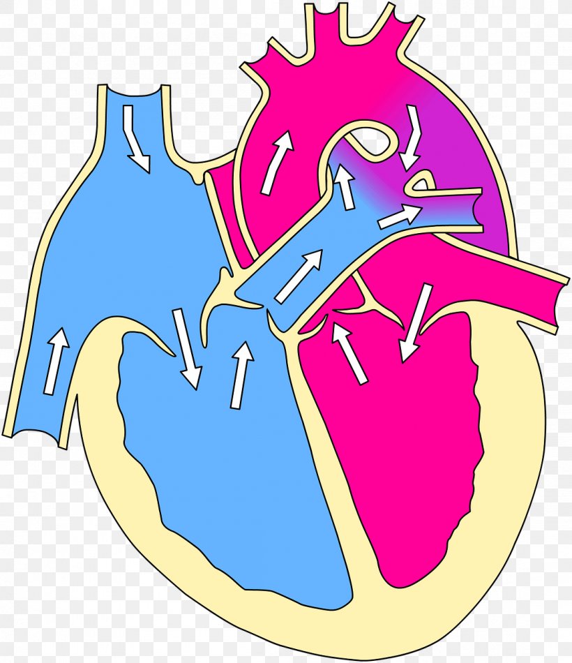 Tetralogy Of Fallot Ventricular Septal Defect Congenital Heart Defect Patent Ductus Arteriosus, PNG, 1104x1280px, Watercolor, Cartoon, Flower, Frame, Heart Download Free
