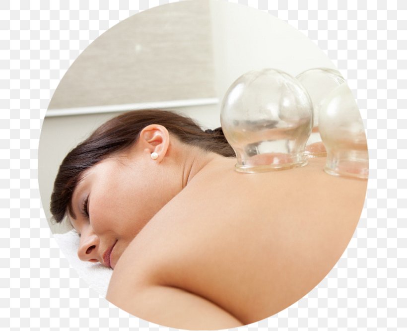 Cupping Therapy Alternative Health Services Centro Médico Jardins Massage Ventosa, PNG, 667x667px, Cupping Therapy, Alternative Health Services, Chin, Jardins, Massage Download Free