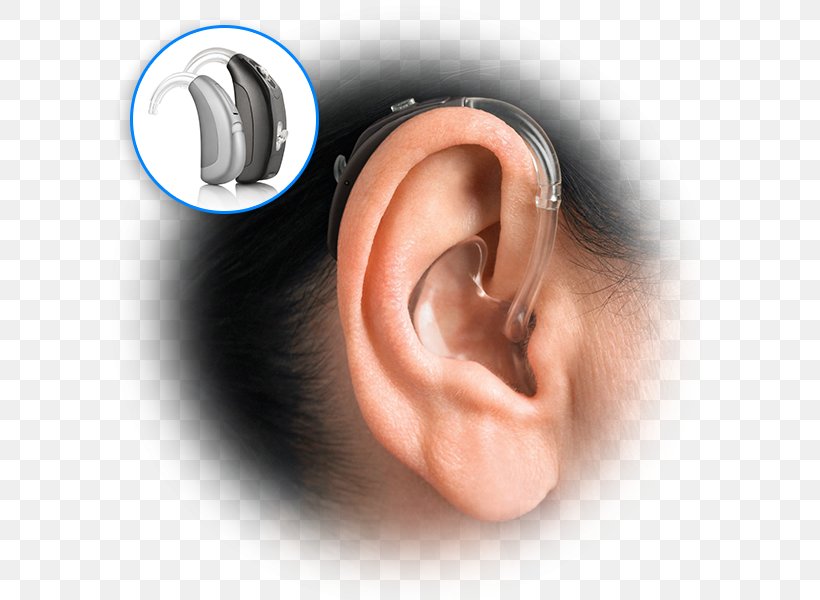 Hearing Aid Earmold Audiology, PNG, 600x600px, Hearing Aid, Audiology, Boneanchored Hearing Aid, Chin, Close Up Download Free