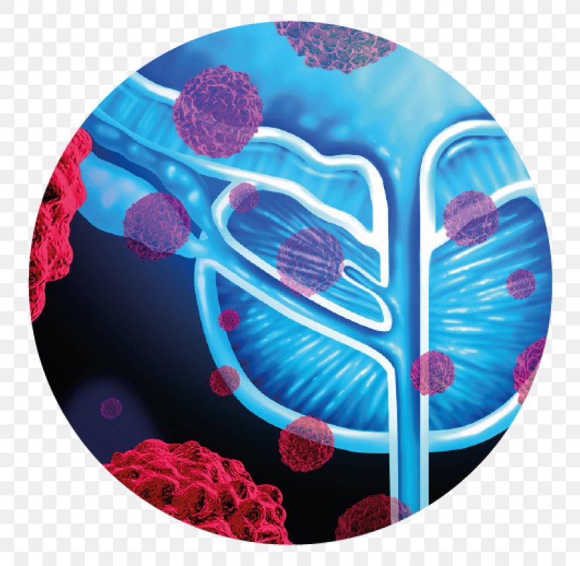 Prostate Cancer Prostate-specific Antigen Metastasis Medical Imaging, PNG, 800x800px, Prostate Cancer, Aqua, Cancer, Electric Blue, External Beam Radiotherapy Download Free