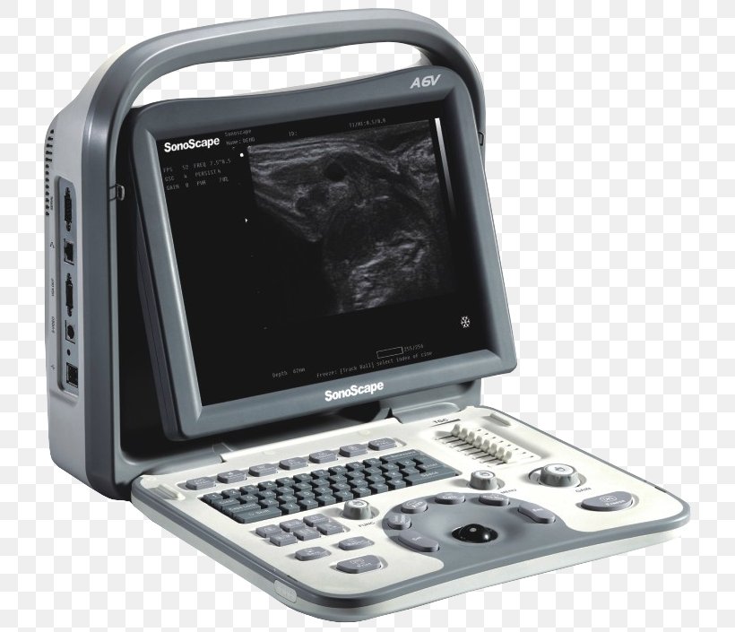 Ultrasonography Equine Ultrasound Veterinarian Veterinary Medicine, PNG, 739x705px, Ultrasonography, Color Doppler, Computer Monitor Accessory, Display Device, Doppler Fetal Monitor Download Free