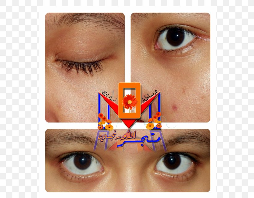 Eyelash Extensions Collagen Muhammad Periorbital Dark Circles, PNG, 640x640px, Eyelash Extensions, Algeria, Artificial Hair Integrations, Collagen, Cosmetics Download Free