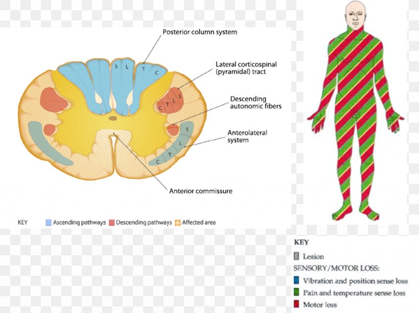 Graphic Design Neuroanatomy Neuroscience Brain Ache, PNG, 1181x883px, Watercolor, Cartoon, Flower, Frame, Heart Download Free