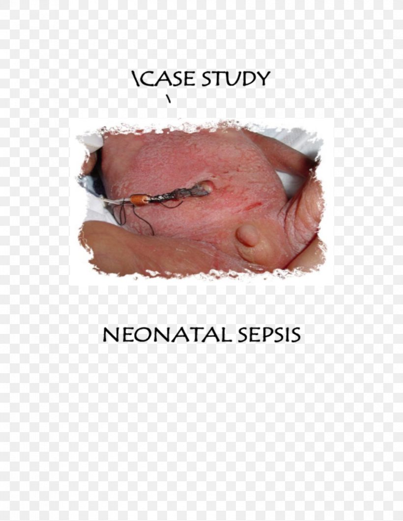 Neonatal Sepsis Infant Neonatology Preterm Birth, PNG, 850x1100px, Watercolor, Cartoon, Flower, Frame, Heart Download Free