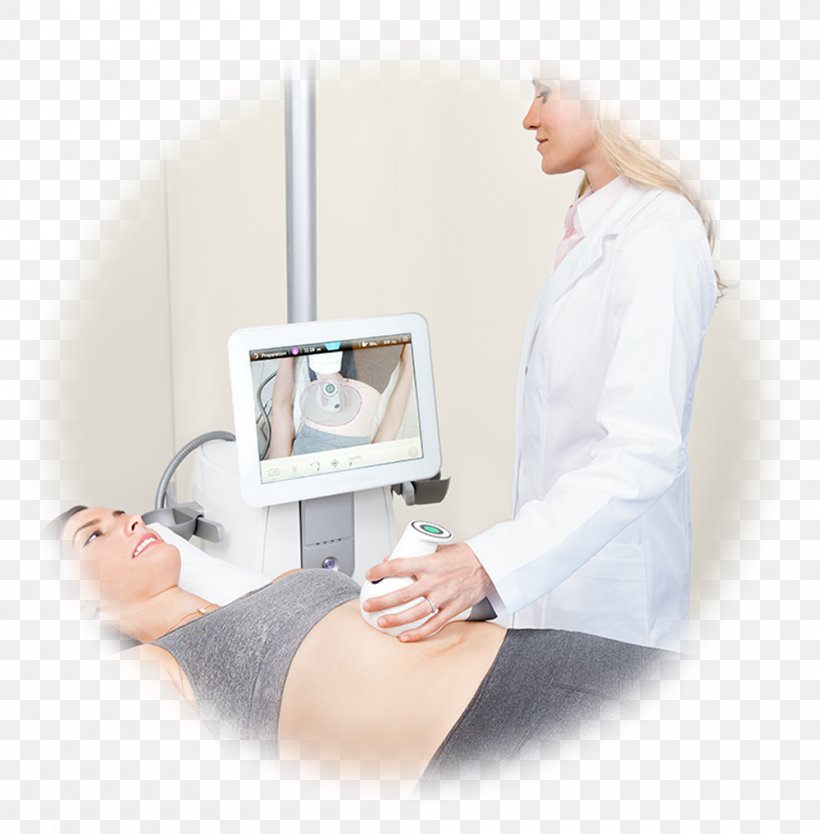 Therapy UltraShape Liposuction High-intensity Focused Ultrasound, PNG, 1000x1018px, Therapy, Abdomen, Aesthetics, Arm, Body Contouring Download Free
