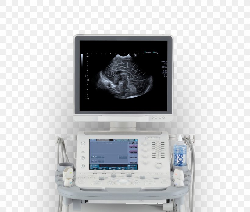 Ultrasound Ultrasonography Medicine Medical Diagnosis Surgery, PNG, 1000x850px, Ultrasound, Acuson, Angiology, Canon Medical Systems Corporation, Display Device Download Free