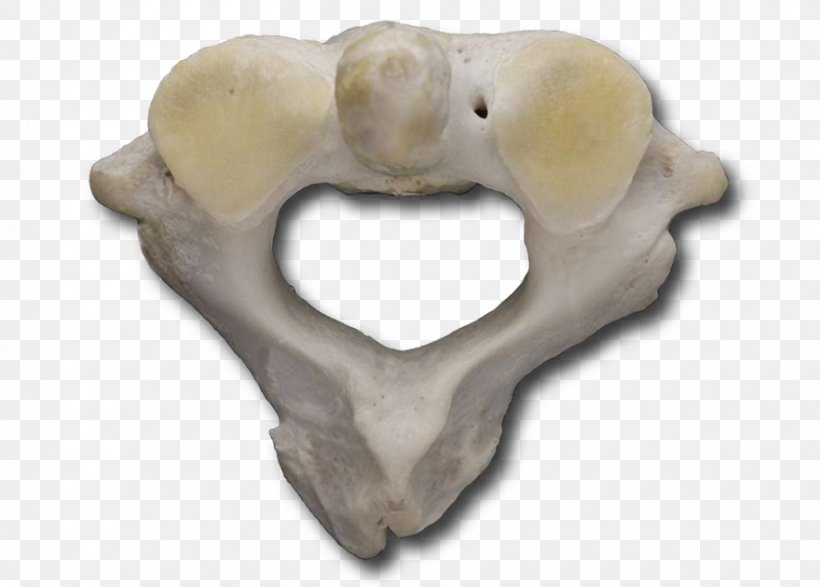 Atlas Anatomy Bone Snout Vertebral Column, PNG, 880x630px, Atlas, Anatomy, Bone, Head Restraint, Jaw Download Free