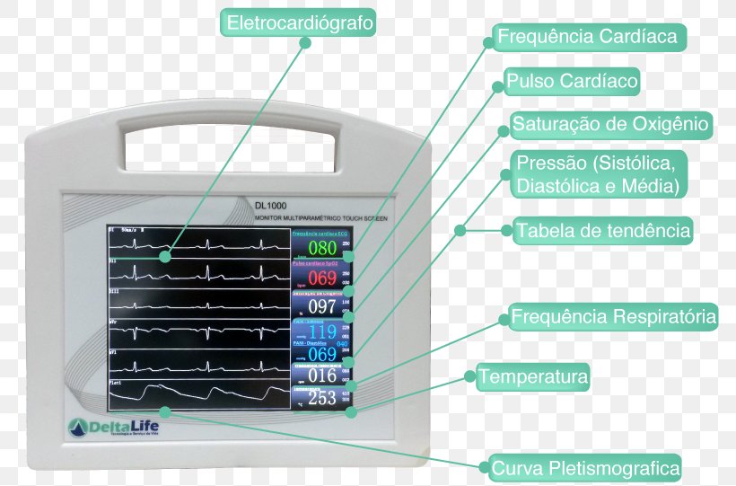 Electronic Visual Display Computer Monitors Touchscreen Presio Arterial Capnography, PNG, 805x541px, Electronic Visual Display, Capnography, Communication, Computer Monitors, Computer Software Download Free