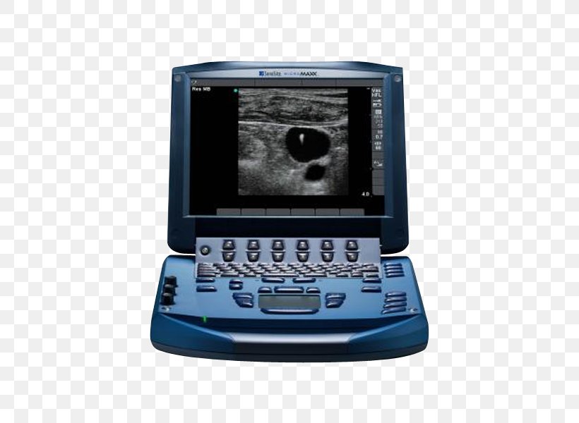 Acuson Ultrasonography Portable Ultrasound SonoSite, Inc., PNG, 600x600px, Acuson, Display Device, Electronic Device, Electronics, Gadget Download Free