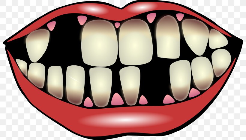 Tooth Pathology Tooth Decay Dentistry Clip Art, PNG, 800x469px, Watercolor, Cartoon, Flower, Frame, Heart Download Free