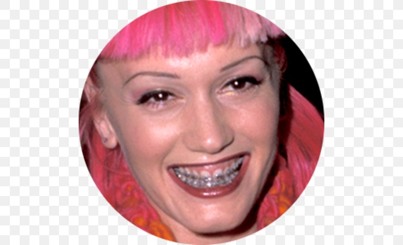 Gwen Stefani Singer-songwriter Celebrity Dental Braces Plastic Surgery, PNG, 500x500px, Watercolor, Cartoon, Flower, Frame, Heart Download Free