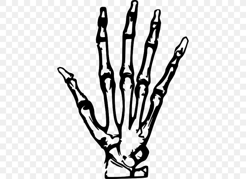 Hand X-ray Clip Art, PNG, 438x599px, Hand, Black And White, Bone, Branch, Favicon Download Free