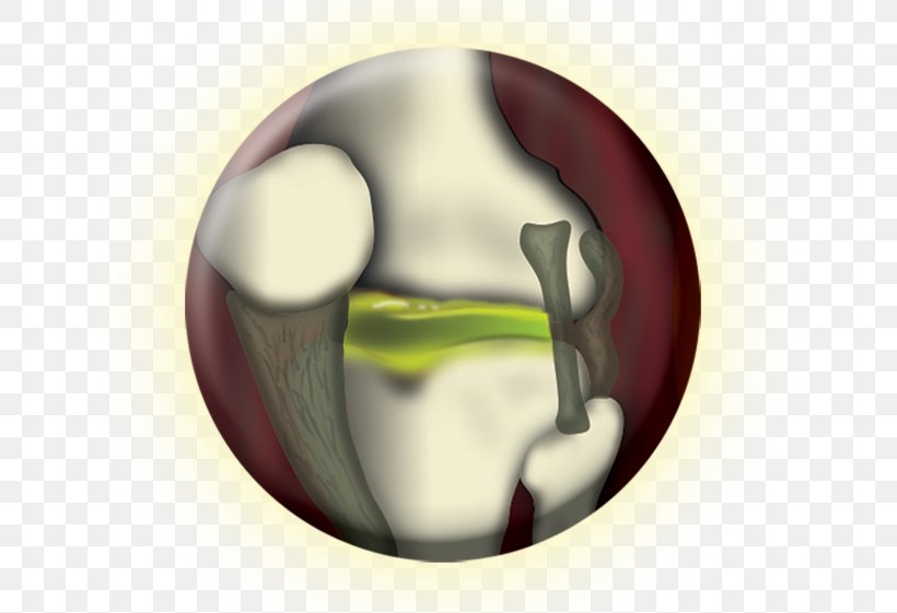 Joint Glucosamine Cartilage Chondroitin Sulfate Bone, PNG, 640x561px, Joint, Bone, Cartilage, Chloride, Chondroitin Download Free