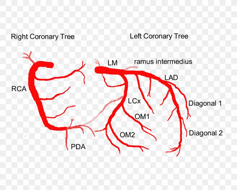 Coronary Arteries Left Coronary Artery Heart Anatomy, PNG, 1000x800px, Watercolor, Cartoon, Flower, Frame, Heart Download Free