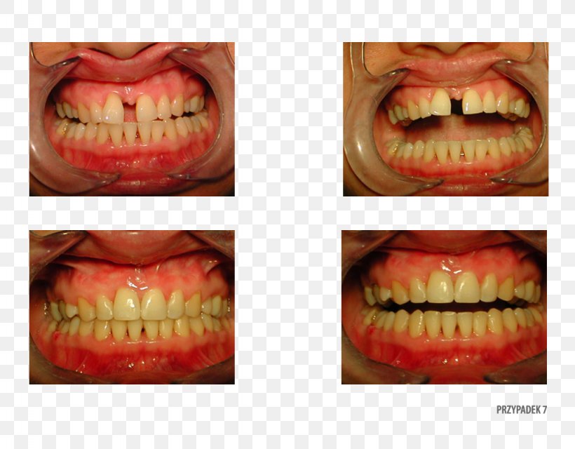 Orange Polska Close-up Therapy, PNG, 1024x800px, Orange, Close Up, Closeup, Jaw, Lip Download Free