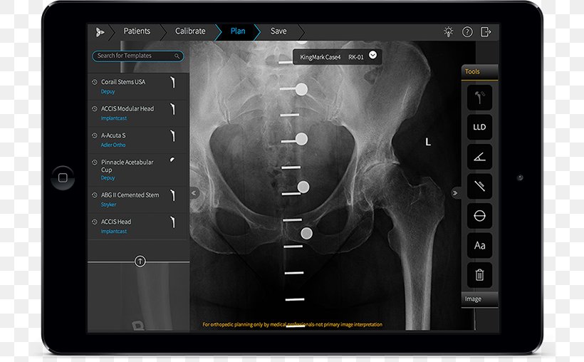 Orthopedic Surgery Computer Software, PNG, 800x508px, Surgery, App Store, Apple, Computer Software, Electronics Download Free