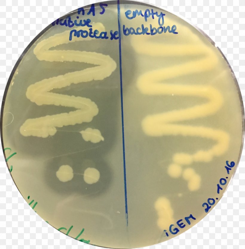 Agar Plate Protease Petri Dishes Assay, PNG, 884x899px, Agar Plate, Agar, Assay, Bacteria, Cell Culture Assay Download Free