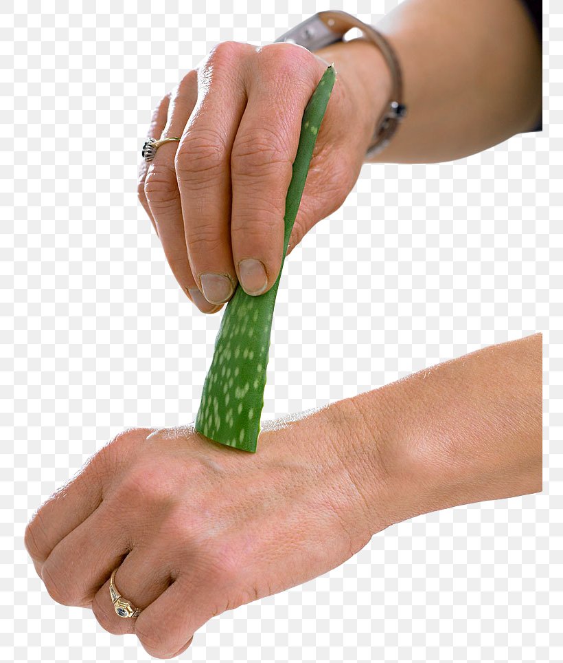 Aloe Plant Reproduction Thumb Nail, PNG, 760x964px, Aloe, Arm, Finger, Hand, Leaf Download Free