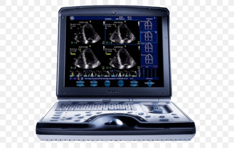 Ultrasonography SonoSite, Inc. GE Healthcare Cardiology Medical Equipment, PNG, 600x519px, 3d Ultrasound, Ultrasonography, Cardiology, Cardiovascular Disease, Display Device Download Free