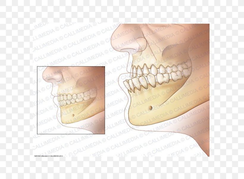 Acromegaly Prognathism Jaw Endocrinology Growth Hormone, PNG, 600x600px, Acromegaly, Anabolika, Endocrinology, Finger, Foot Download Free