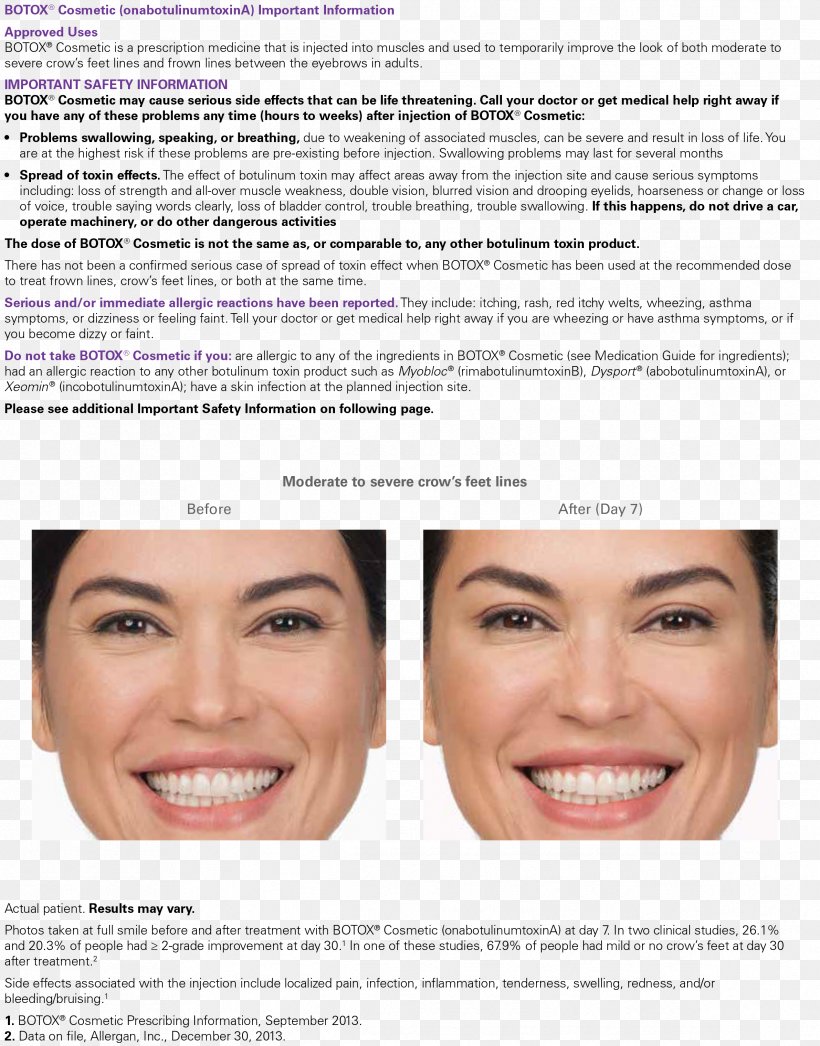 Botulinum Toxin Wrinkle Injectable Filler Eye Restylane, PNG, 2382x3041px, Botulinum Toxin, Adverse Effect, Beauty, Cheek, Chin Download Free