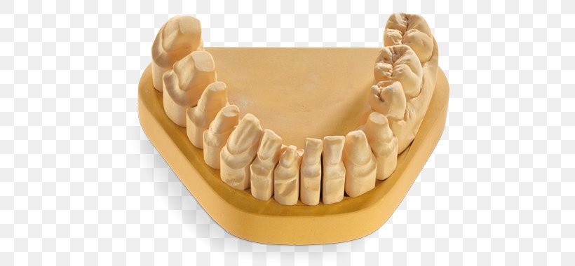 Dental Laboratory Dentistry Dental Technician Dental Laser Saw, PNG, 709x380px, Dental Laboratory, Concept, Cutting, Dental Laser, Dental Technician Download Free