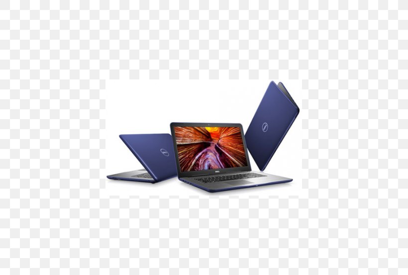 Dell Inspiron Laptop 2-in-1 PC Computer, PNG, 395x554px, 2in1 Pc, Dell, Alienware, Computer, Dell Inspiron Download Free