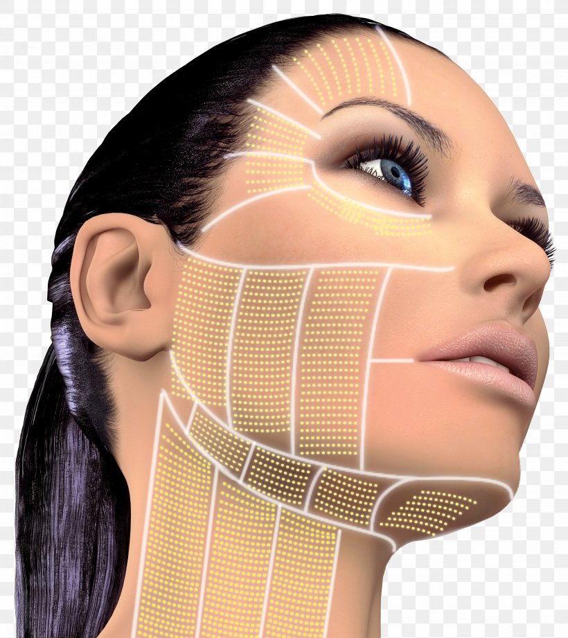 High-intensity Focused Ultrasound Therapy Rhytidectomy Surgery Skin, PNG, 2669x3000px, Highintensity Focused Ultrasound, Cheek, Chin, Eyebrow, Eyelash Download Free