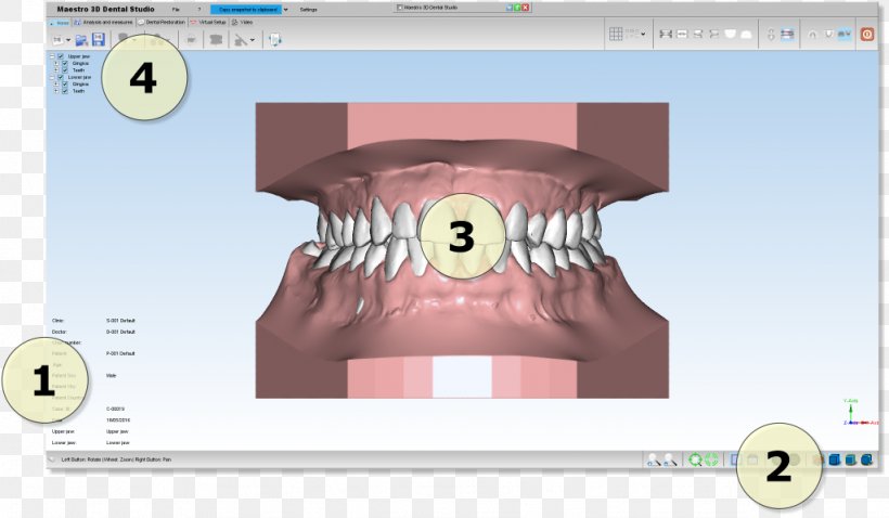 Dentistry Computer Software Product Manuals Open Dental Orthodontics, PNG, 1024x598px, Watercolor, Cartoon, Flower, Frame, Heart Download Free