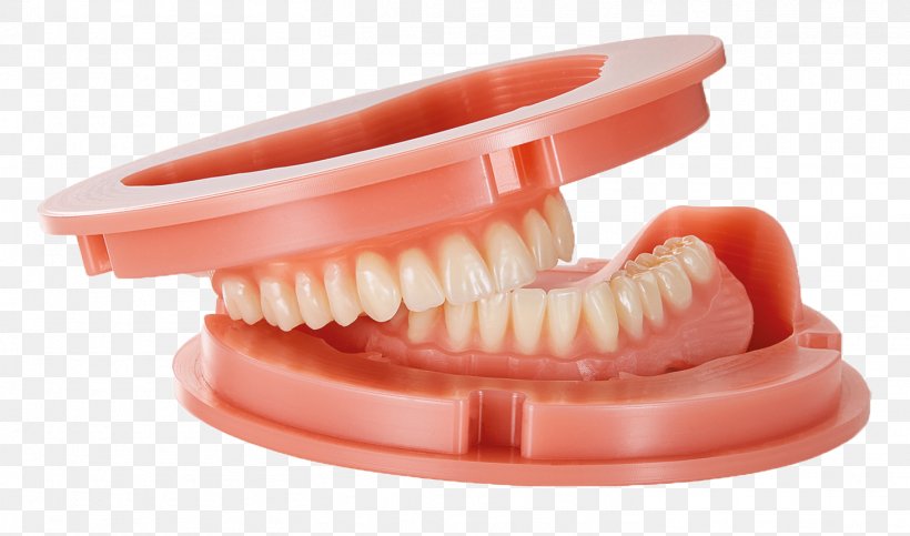 Tooth Dentures Dental Laboratory Dentistry, PNG, 1463x862px, Tooth, Abformung, Cadcam Dentistry, Crown, Dental Laboratory Download Free