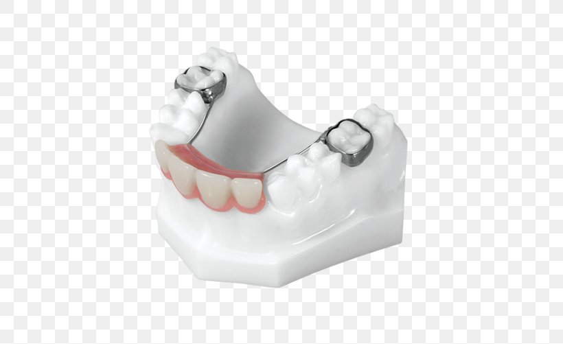 Plastic, PNG, 705x501px, Plastic, Jaw, Tooth Download Free