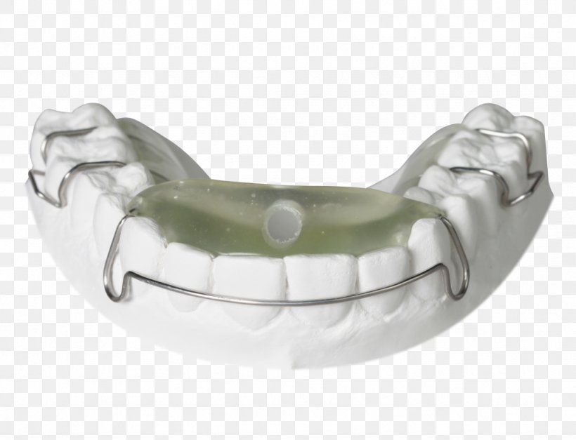 Sleep Apnea Orthodontics Sleep And Breathing Dentist, PNG, 1024x783px, Sleep Apnea, Apnea, Body Jewelry, Clinic, Dentist Download Free