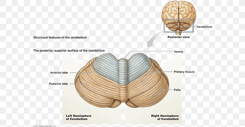 Posterior Cranial Fossa Cerebellum Brainstem Cerebral Cortex, PNG, 600x425px, Cerebellum, Anatomy, Bone, Brain, Brain Tumor Download Free