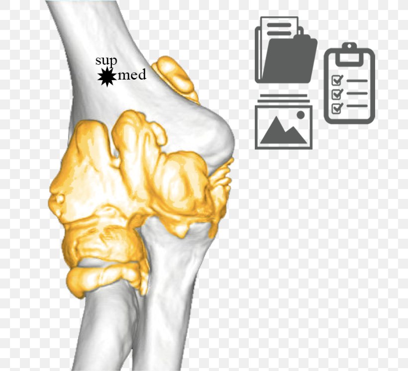 Thumb Ulnar Nerve Elbow Joint Humerus, PNG, 746x746px, Thumb, Arm, Arthrology, Bone, Elbow Download Free