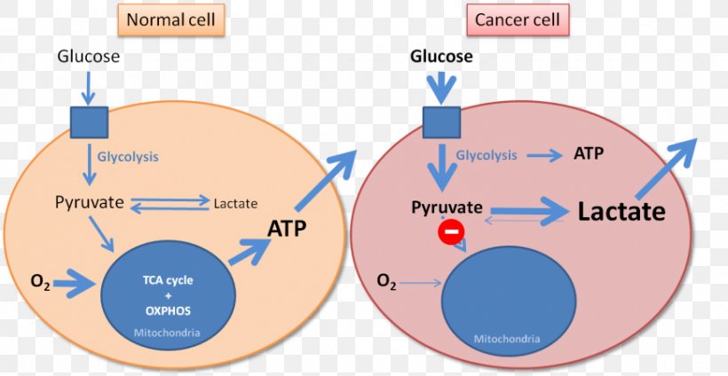 Warburg Effect Cancer Warburg Hypothesis Glycolysis Metabolism, PNG, 870x450px, Cancer, Cancer Cell, Carcinogen, Carcinoma, Cell Download Free