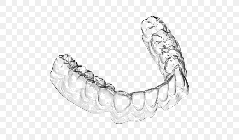 Clear Aligners Dental Braces Orthodontics Tooth Dentistry, PNG, 640x480px, Clear Aligners, Body Jewelry, Bracelet, Dental Braces, Dental Laboratory Download Free