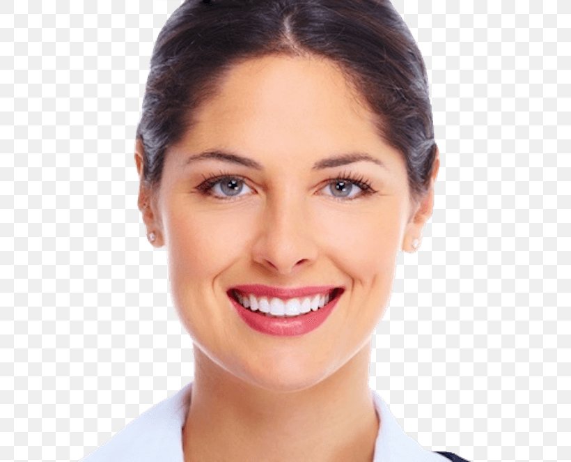 Cosmetic Dentistry Veneer Crown, PNG, 800x663px, Dentist, Beauty, Bridge, Brown Hair, Cheek Download Free