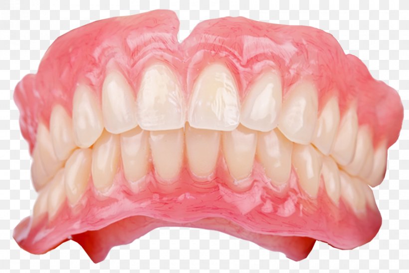Dentistry Dental Implant Dentures Dental Laboratory Dental Technician, PNG, 900x601px, Dentistry, Bridge, Crown, Dental Braces, Dental Implant Download Free